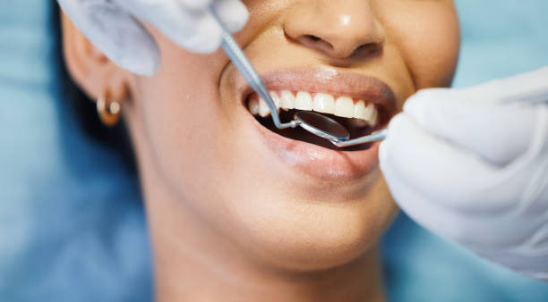 Best Dental Abscess Treatment in Raleigh Hills, OR